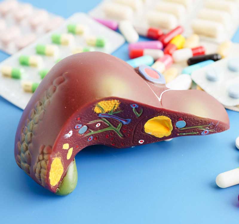Fatty Liver (NAFLD)