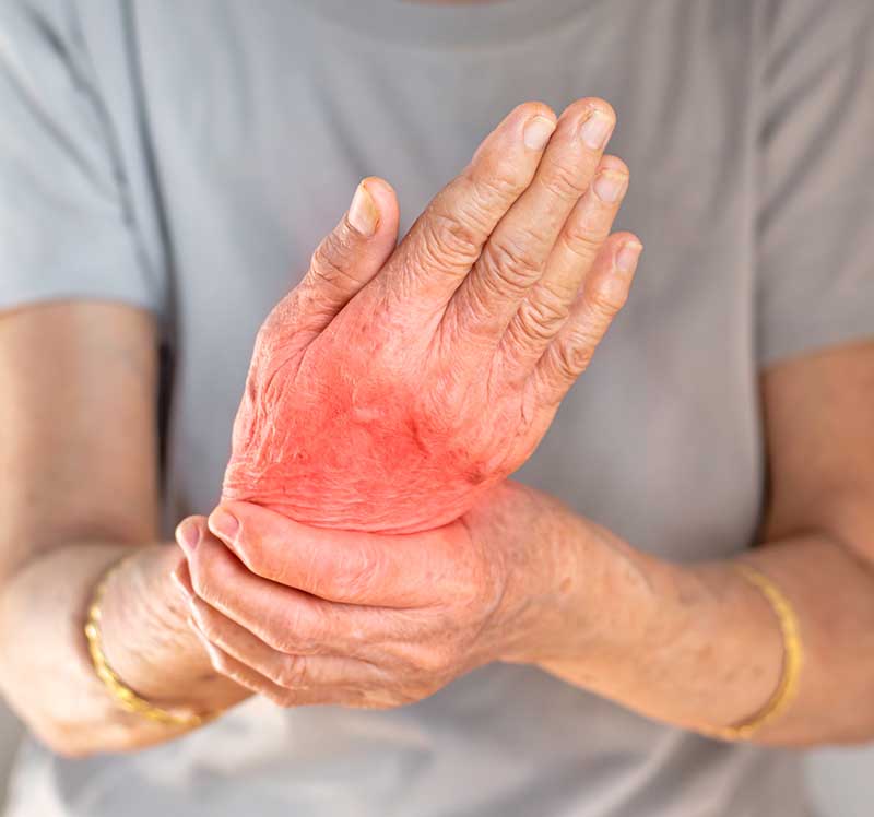 Gout