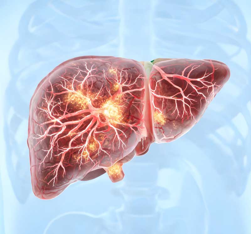 Free Fibroscan liver scan